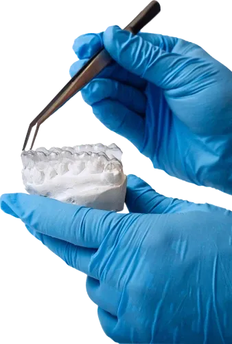 Bagues orthodontiques esthétiques posées sur les dents