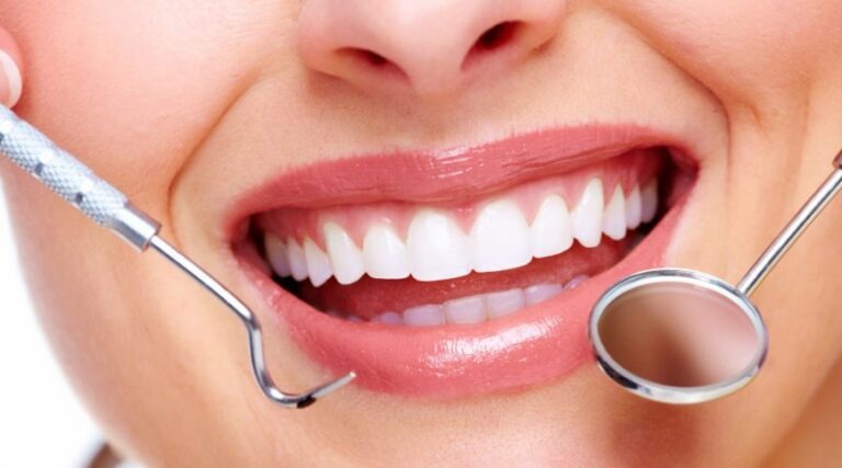 Sourire éclatant après blanchiment dentaire professionnel
